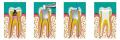 Endodonzia