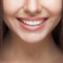 Sorriso Turrin Massimo
