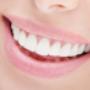 Sorriso Perfetto