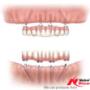 Implantologia dentale