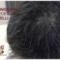 BioPelle Hair Replacement www.istitutogiglio.com