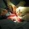 Sterilizzazione dettaglio