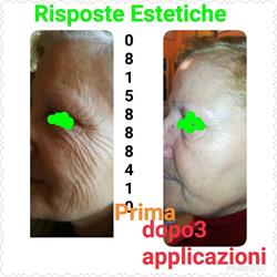 Risposte Estetiche Di Lucia Minopoli