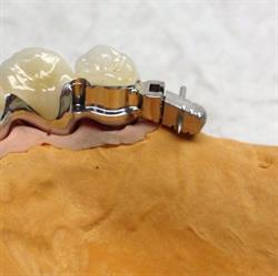 Ancordent S.R.L. ATTACCHI DENTALI E FORNITURE