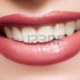 sorriso