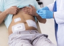 Medicazioni a domicilio a Vicenza