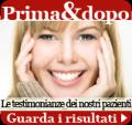Lifting del viso-IEI- Istituto Estetico Italiano