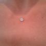 Microdermal