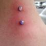 Nape microdermal