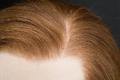 Protesi Capelli veri