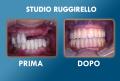 Implantologia