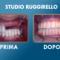 Implantologia
