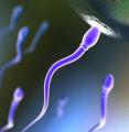 L’ipertrofia prostatica può cambiare le caratteristiche del liquido seminale
