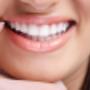 Sorriso Perfetto