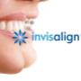 Invisalign