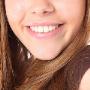 Sbiancamento Denti