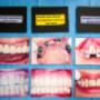 Gallery Professionale