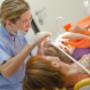 Sbiancamento Denti