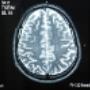 Radiografia del Cervello