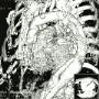 Sostituzione Aorta Torace