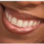 Sorriso
