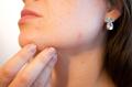 Irritazioni cutanee  Fate attenzione all’acqua dura