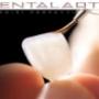Faccette Dentali