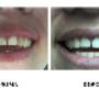 Conservativa / Endodonzia