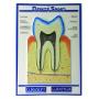 Sezione di Un Dente