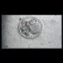 Microparticella