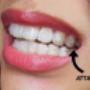 Mal di Denti Catania