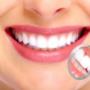 Igiene Orale - Studio Medico Dentistico Mummolo e Bucari
