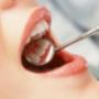 Implantologia - Studio Medico Dentistico Mummolo e Bucari