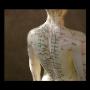Fisioterapia