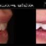 Estetica Dentale