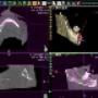 Chirurgia Implantare
