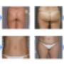 trattamento corpo Relaxharmony Lecce