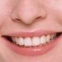 Sorriso Perfetto