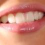 Sorriso