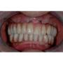Ricostruzione dei Denti