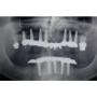 Radiografia