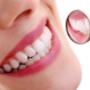Impianti Dentali Low Cost