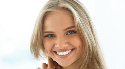 Veneers