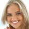 Veneers