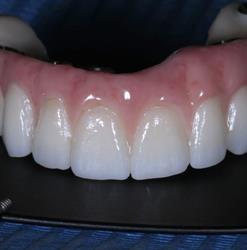 TECNODENTAL di Montagnoli Fabio LAB.PROTESI DENTALE