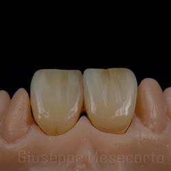 Natural Creation Dental Lab   Mesecorto Giuseppe