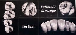 Laboratorio Odontotecnico di Vallarelli Giuseppe