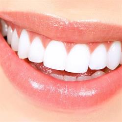 Dental White Sas di Negro Alessandro