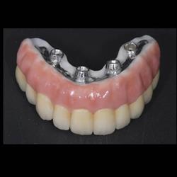 Master 3D Dental Project - laboratorio odontotecnico crotone