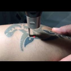 Laser Clinic Milano